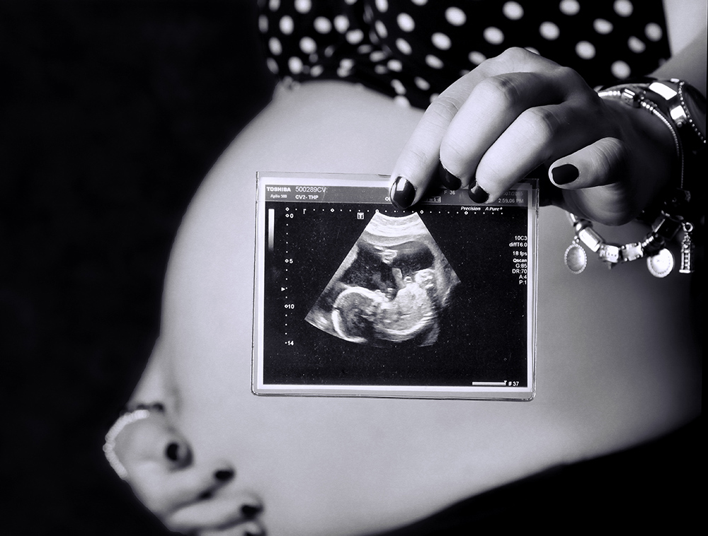 Toronto Maternity Photography